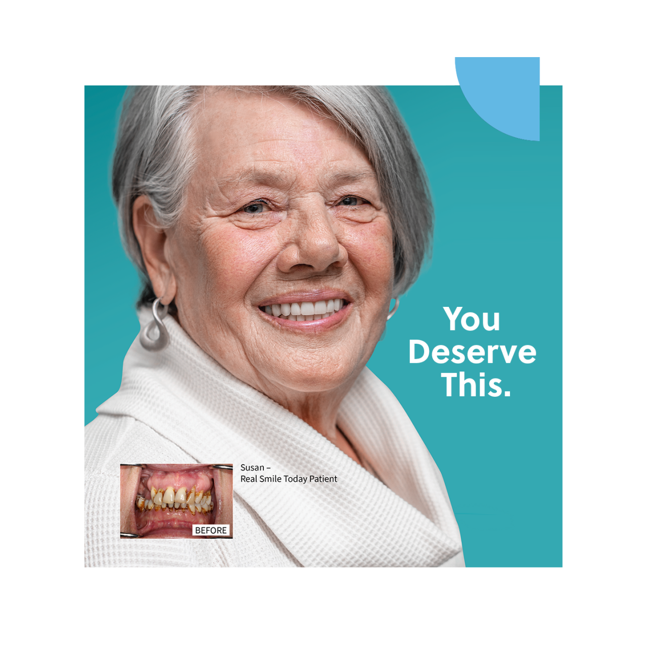 Dental Solutions ZimVie Canada dental-solutions-zimvie-canada
