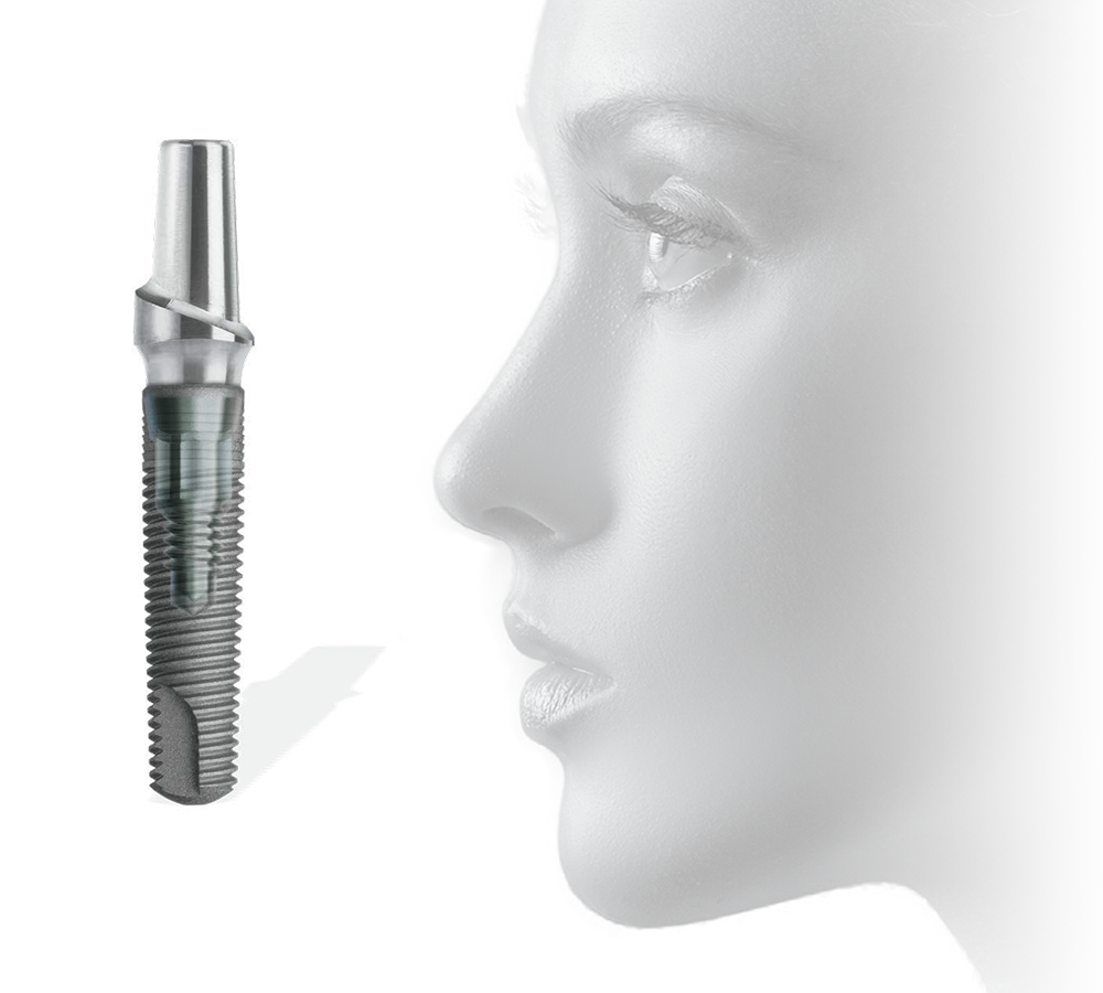 Image of a ZimVie 3-1mmd Eztetic Dental Implant positioned beside a woman’s profile, highlighting features such as restorative stability and simplicity, immediate aesthetics with high primary stability, and long-lasting results supported by coronal design, platform switching, and precise implant-to-abutment connection.