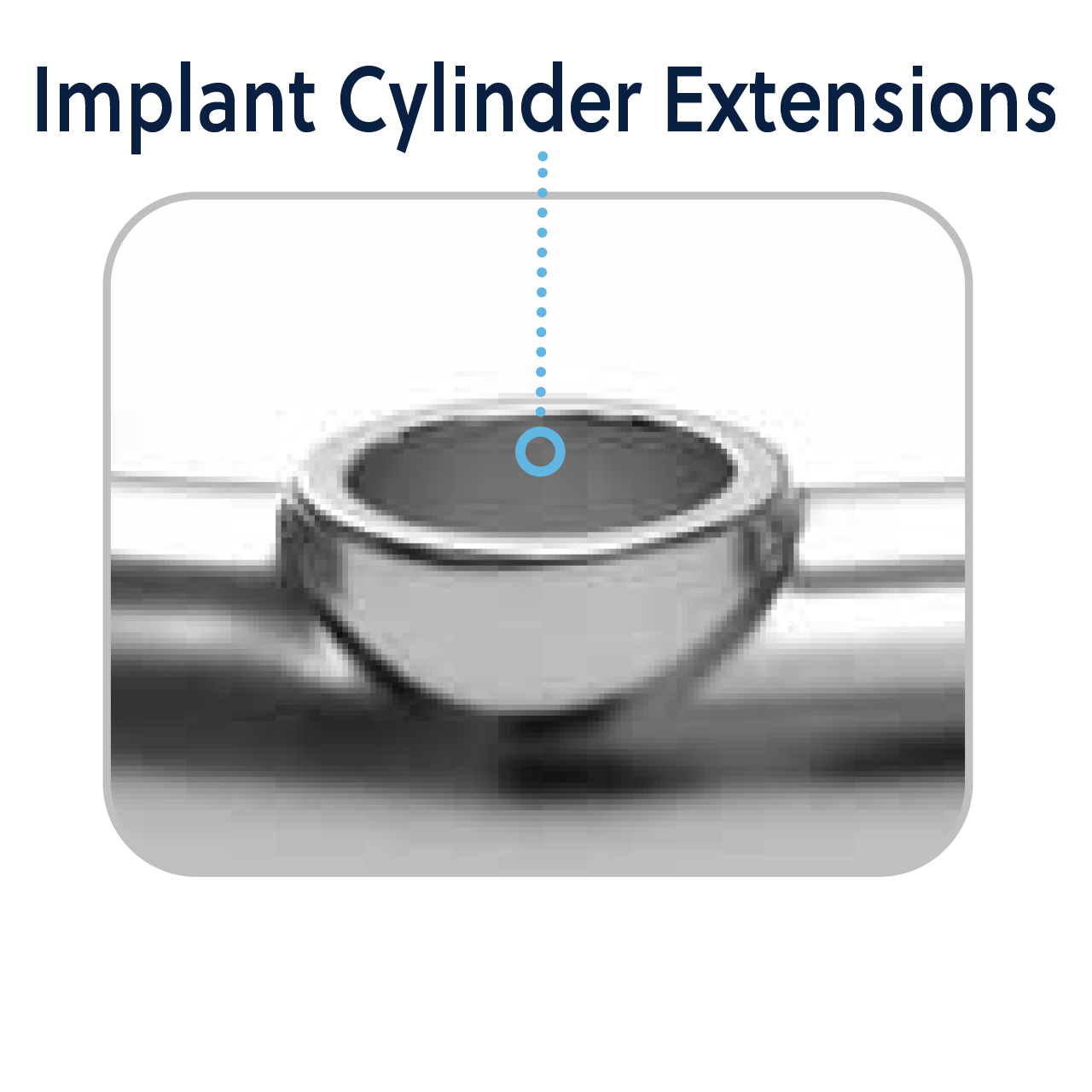 Design features implant cylinder extensions