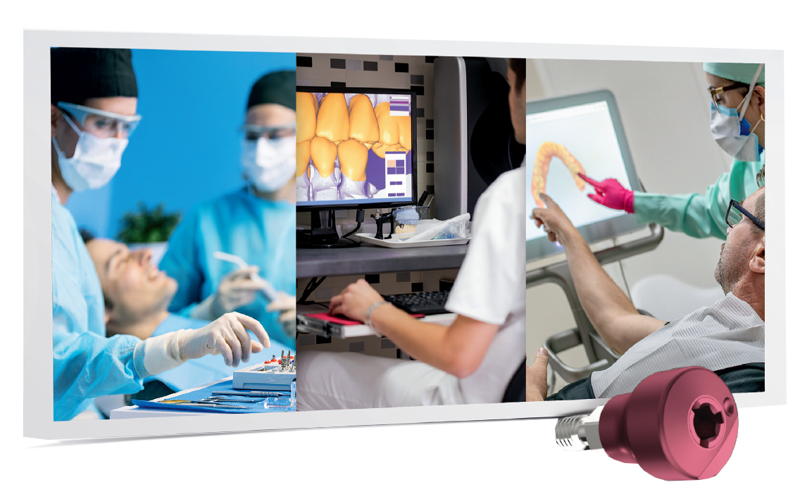 Image showcasing the ZimVie Encode® workflow from surgery to digital design and patient consultation, featuring seamless collaboration between surgical teams, dental labs, and restorative clinicians for efficient, aesthetic, and patient-friendly outcomes.