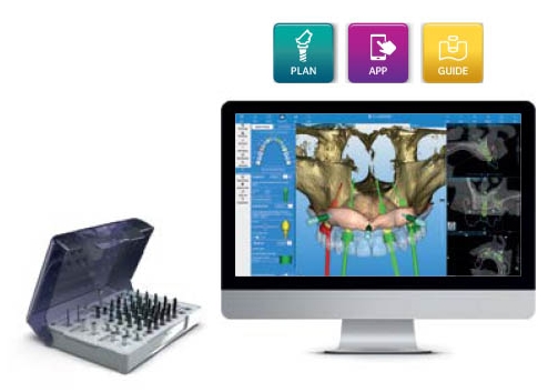 Image of the ZimVie RealGUIDE Z3D Guided Surgery Kit alongside the RealGUIDE Software Suite displayed on a computer screen. The kit provides instruments for precise, planned dental implant surgeries and is compatible with ZimVie’s TSV, Trabecular Metal, and Eztetic Implant Systems. The software suite (PLAN, APP, GUIDE) offers an open platform for diagnosis, advanced surgical guide design, and customized drilling reports to enhance accuracy and preparation for implant therapy.