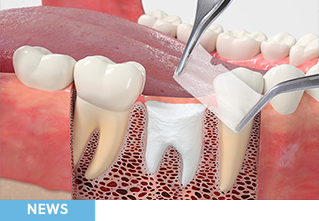 Experience superior handling with our triple-layer amnion/chorion barrier membrane