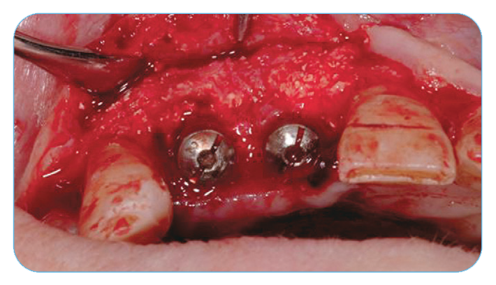 Fig. 12. Regeneration at four months after removing the remnants of the membrane. Fig. 12. Regeneration at four months after removing the remnants of the membrane.