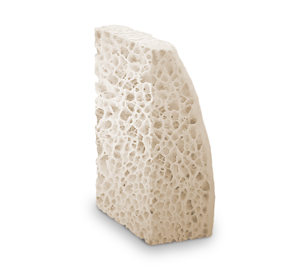 Puros Allograft Block