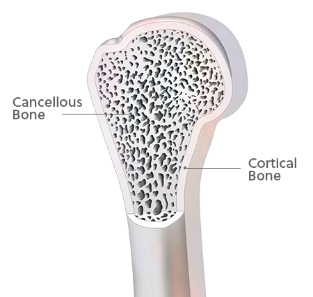 Cancellous and Cortical Bone RegenerOss CC Cortico-Cancellous Particulate