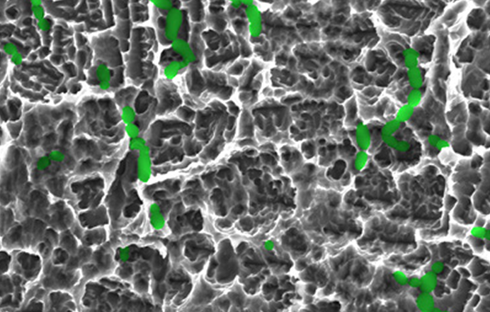 Microscopic view of the ZimVie Immediate Molar Dual Acid-Etched (DAE) surface, showing enhanced texture designed to support optimal osseointegration and bone healing.