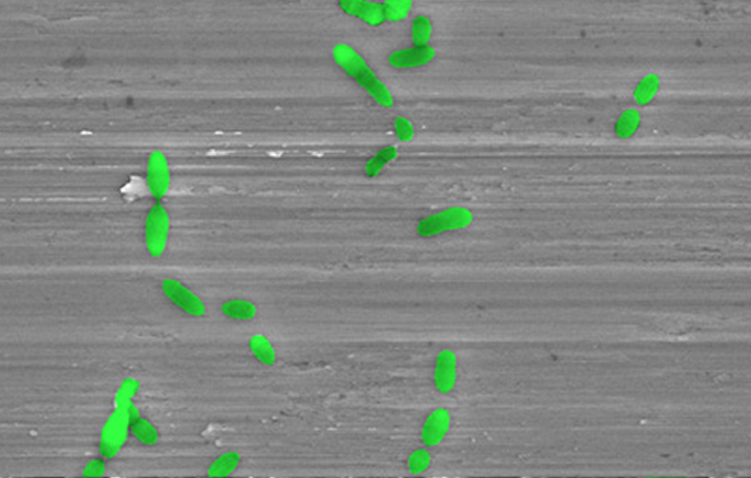Microscopic image of a ZimVie machined implant surface, showing smooth linear texture with green markers highlighting surface characteristics for clinical comparison.