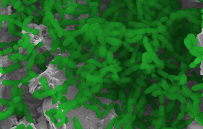 Microscopic view of the BioHorizons Laser-Lok surface, showing laser-created microchannels densely covered with green-marked bacterial or cellular adherence, designed to support tissue integration and implant stability.