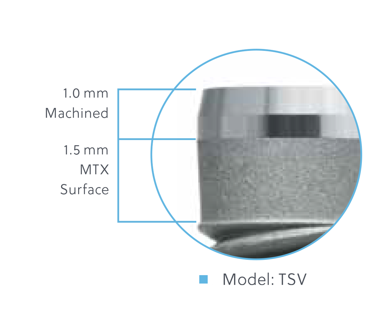 TSV Implant with MTX® Surface TSV Implant Configurations available on select implants Model: TSV