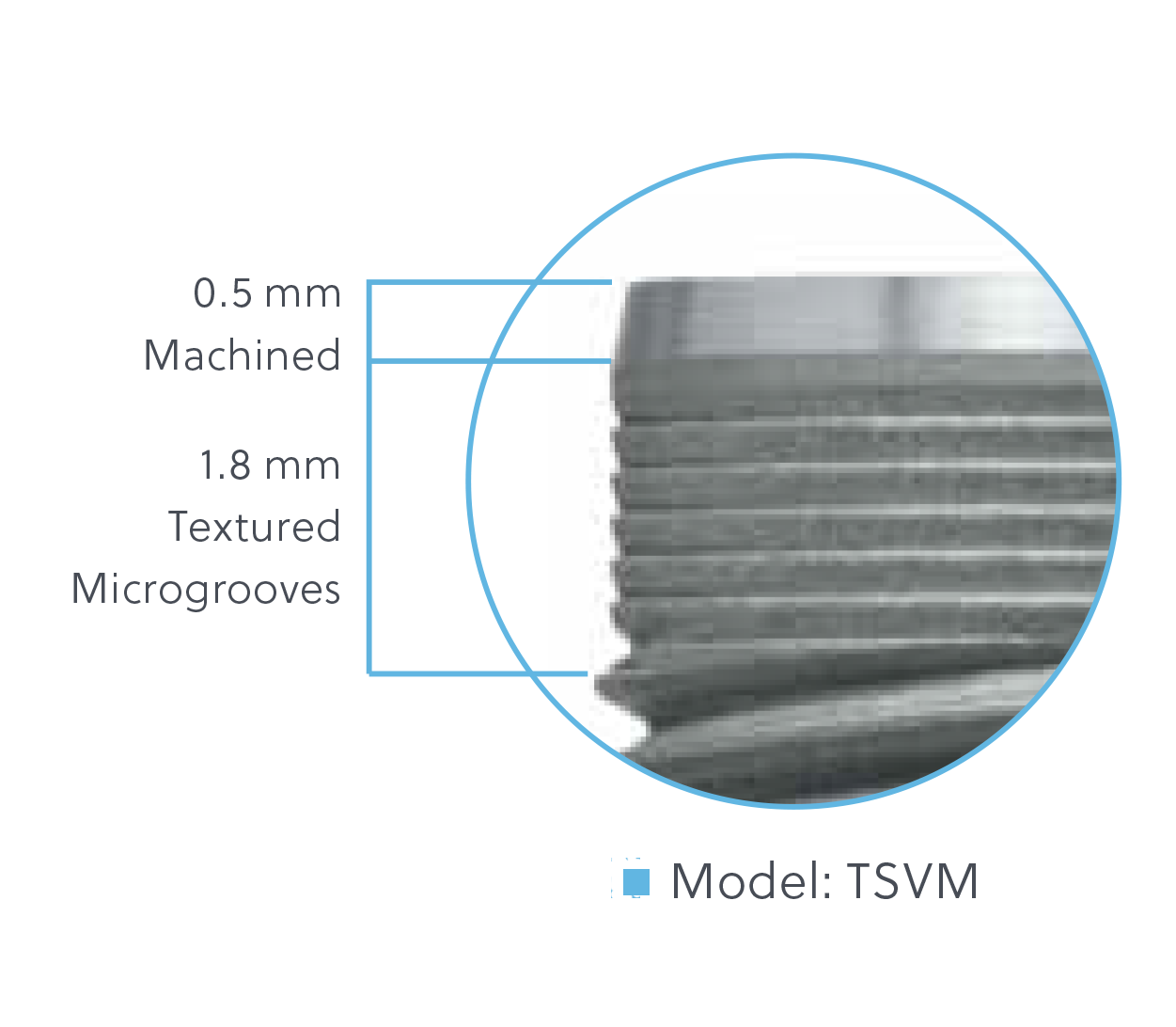 TSV Implant Configurations available on select implants Model: TSVM TSV Implant Configurations available on select implants Model: TSVM