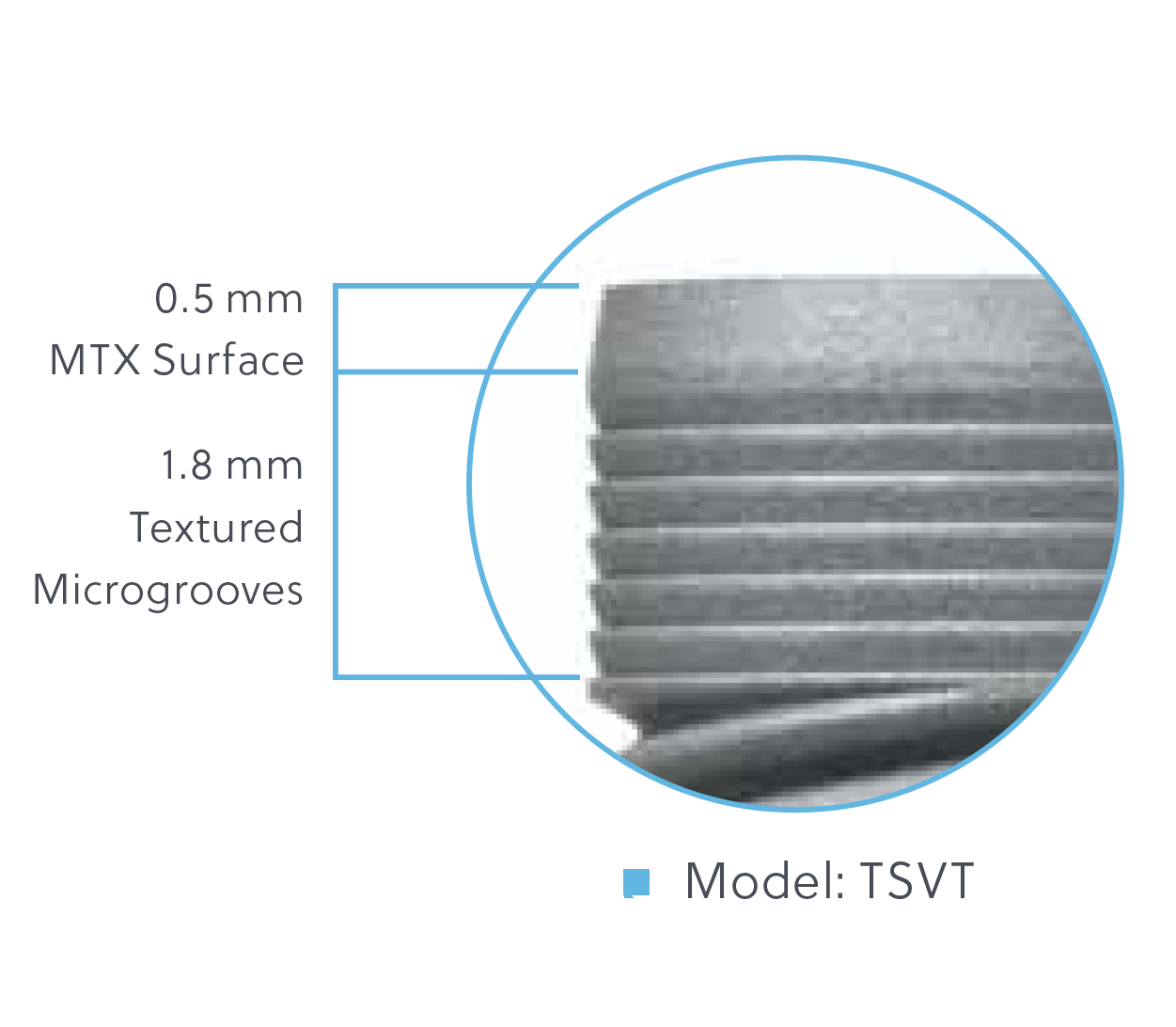 TSV Implant Configurations available on select implants Model: TSVT TSV Implant Configurations available on select implants Model: TSVT