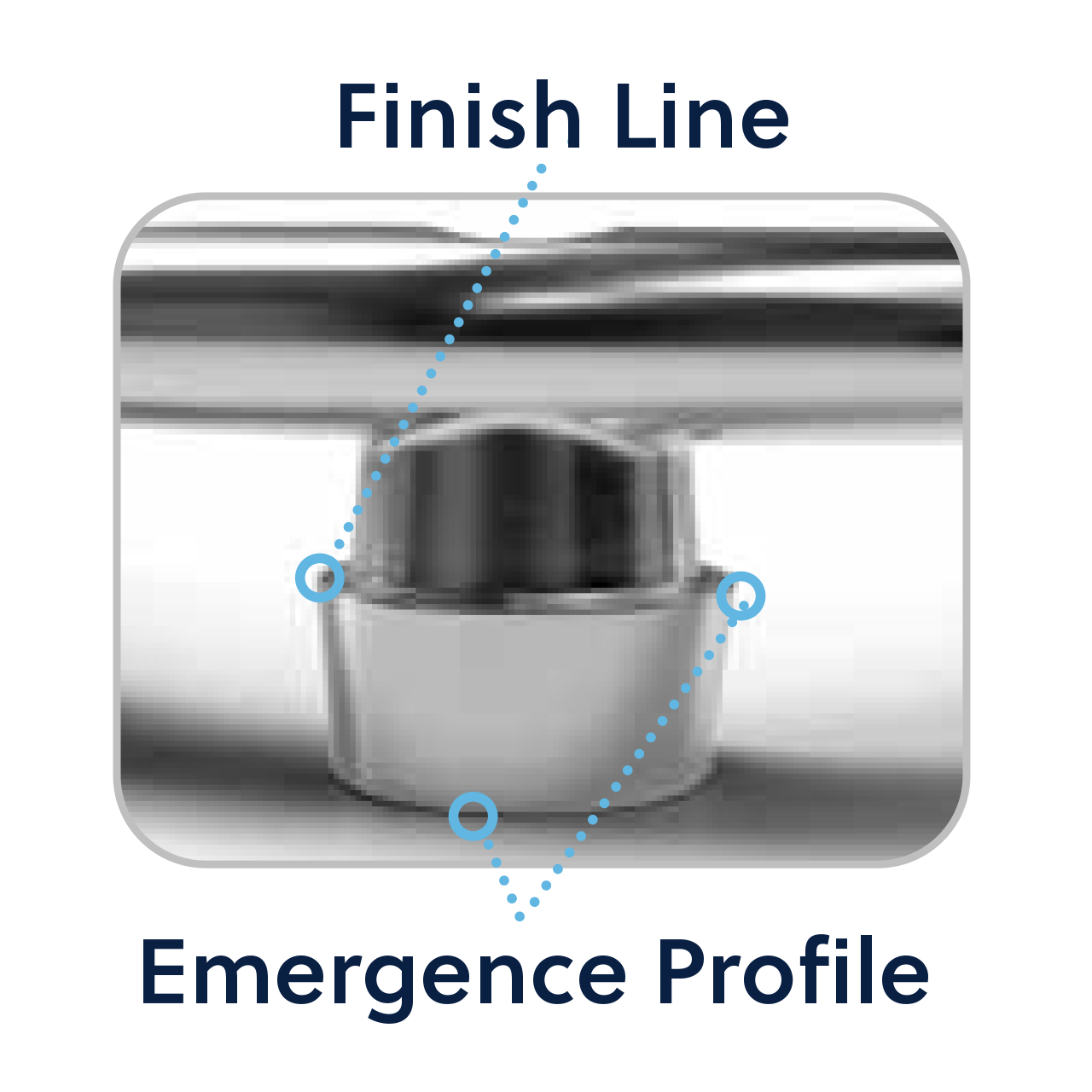 design features emergence profile