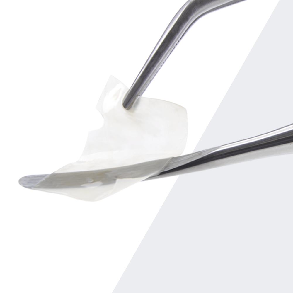 Close-up of a clinician holding the Biotivity® A/C Plus dental membrane with surgical forceps, designed to support guided bone and tissue regeneration.