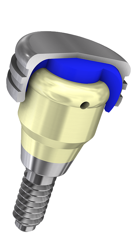 OverdenSURE® Removable Attachment System