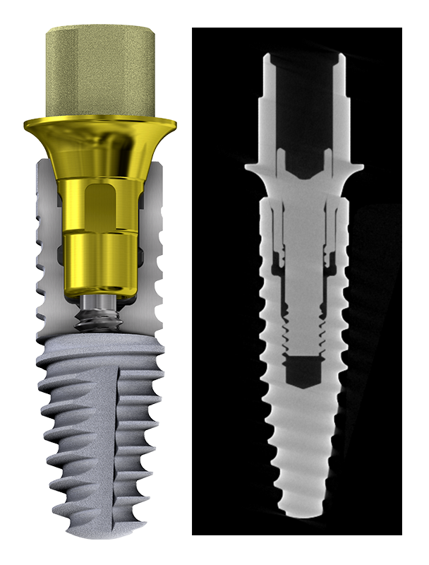 Azure Multi-Platform Prosthetic Solutions Azure Multi-Platform Prosthetic Solutions  Your Connection for Every Connection