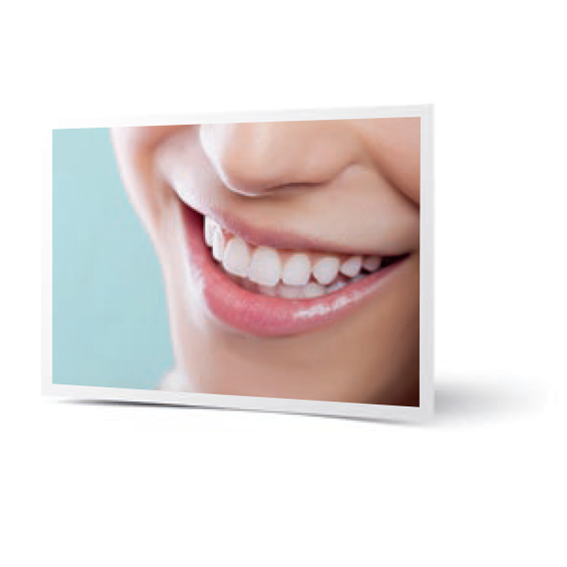 SMILE