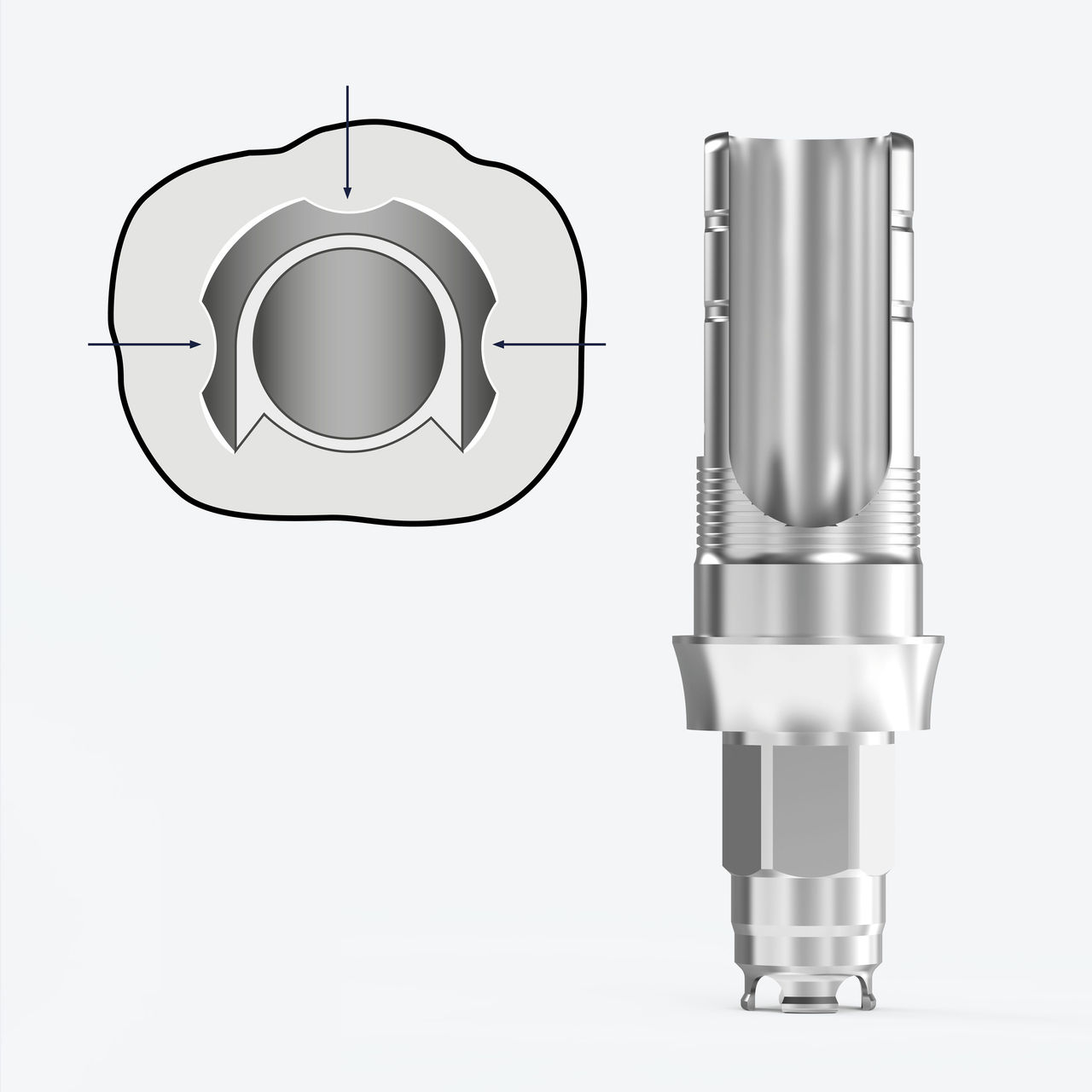 GenTek Abutments Anti-rotation Feature