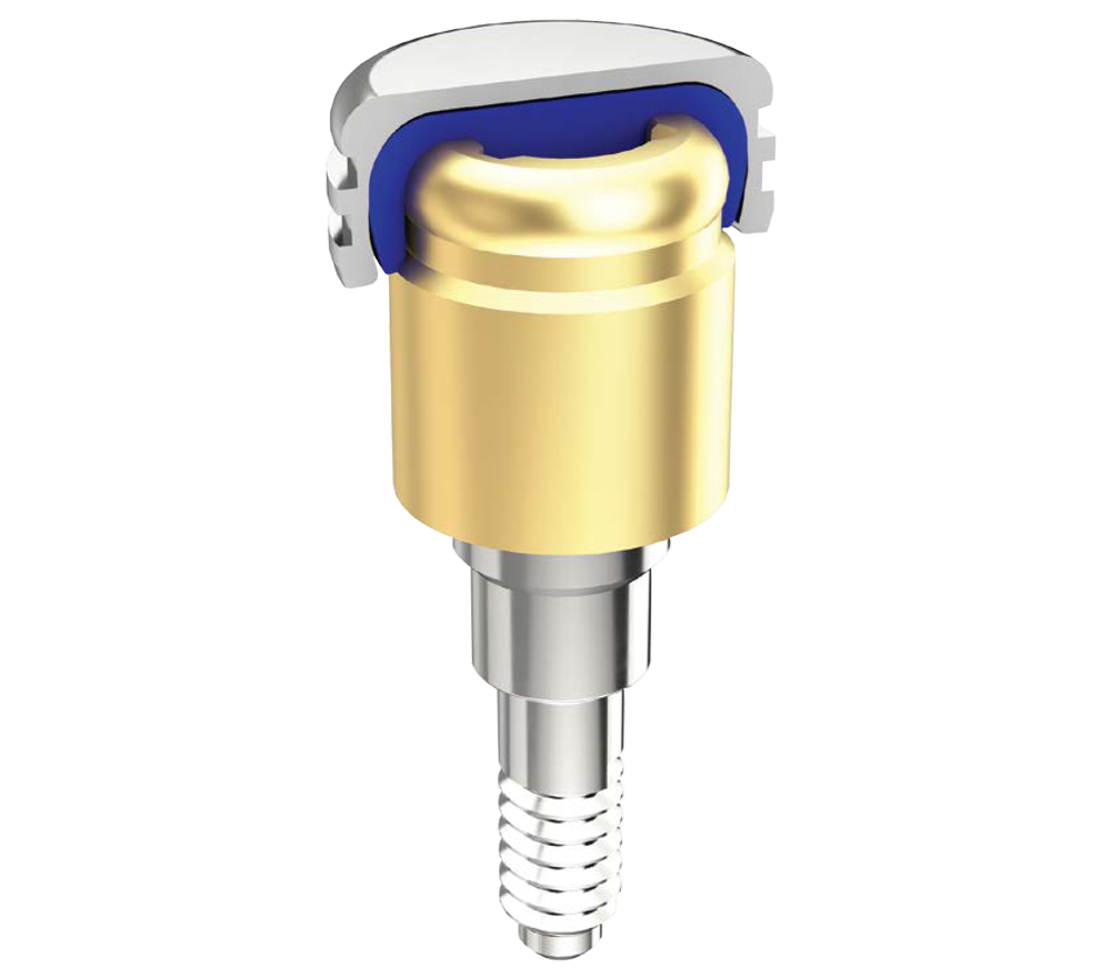 OverdenSURE® Removable Attachment System