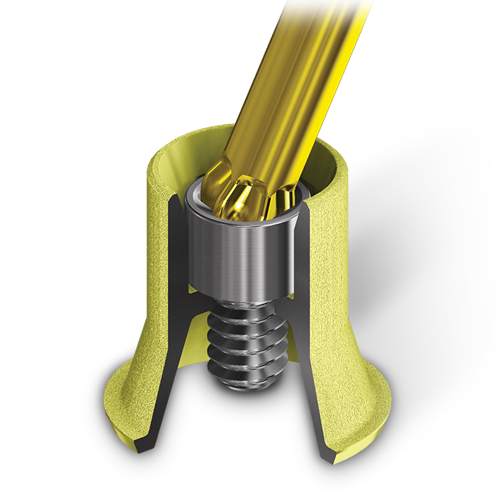 All our Multi-Unit Abutments include a carrier allowing  you to easily place and position the abutment.