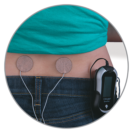 SpinalPak Electrodes Attached to Patient's Lower Back