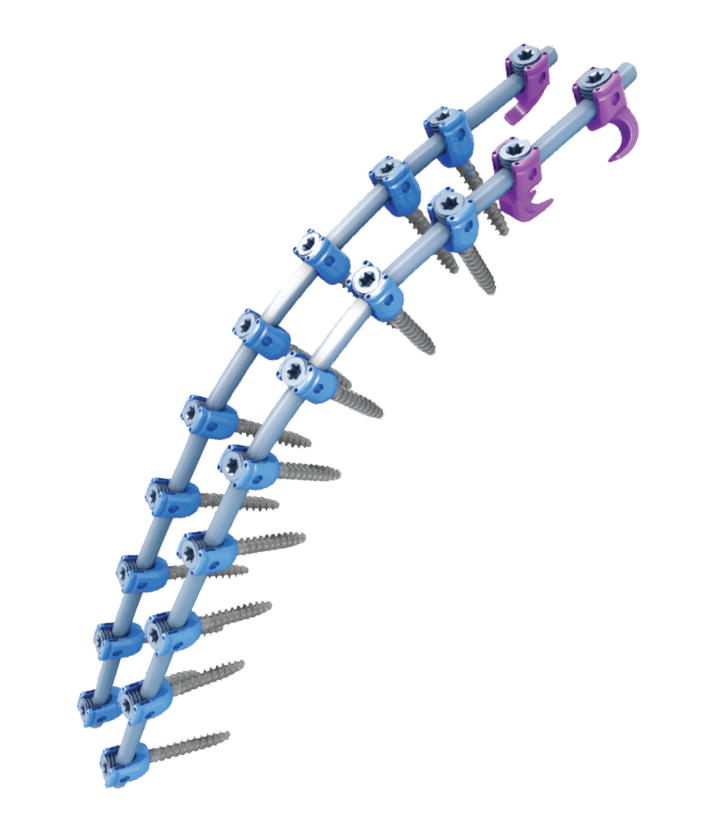 Vital™ Deformity Spinal Fixation System
